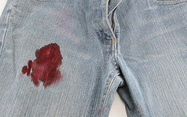 Aprenda a tirar nódoas de sangue na roupa